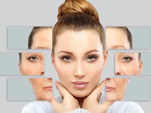 مراقبت های بعد از بوتاکس